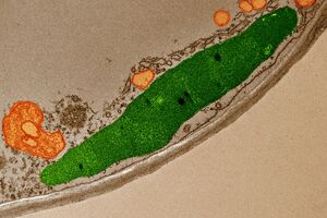 chloroplast